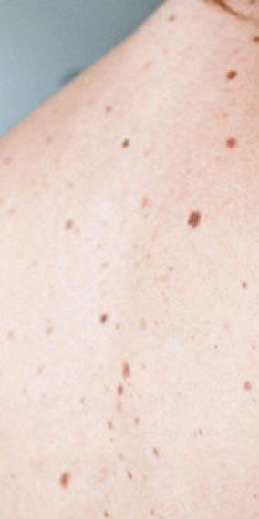 Pricklings: prick me - Rainy days 2025