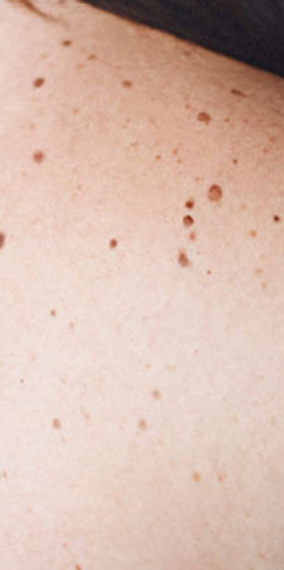 Musici Ireland - Rainy days 2025