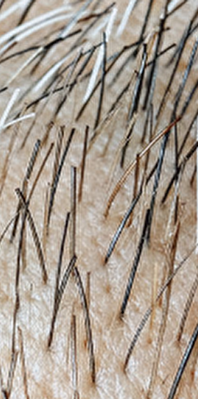 Fabrik Quartet - Rainy days 2025