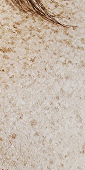 Lovemusic : I Was Wearing My Skin Unfresh - Rainy days 2025